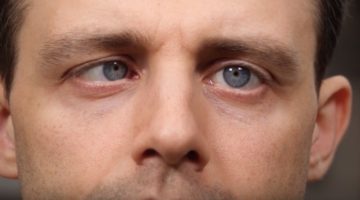 Auge unabhängig voneinander bewegen